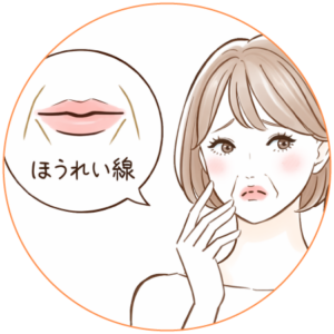 ほうれい線のお悩み