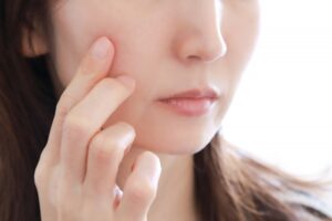 なぜほうれい線が出るのか？