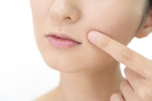 ほうれい線の原因