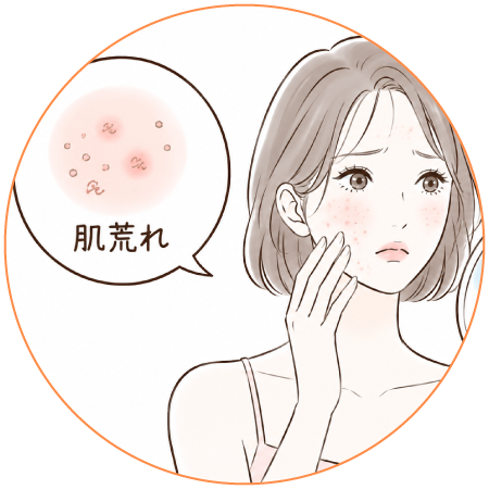 肌荒れ