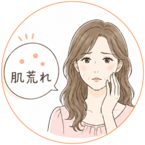 肌荒れ